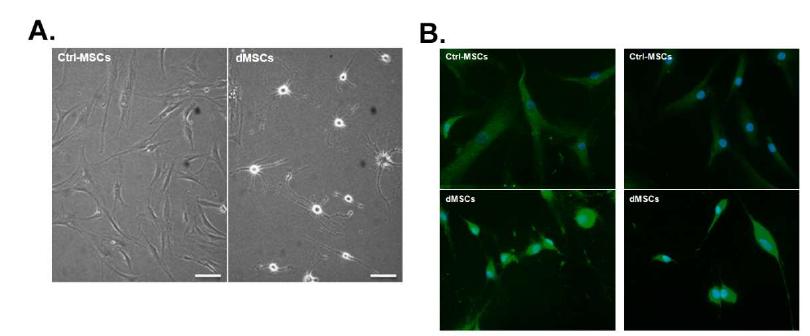 Neuron-like morphological change in human ALS BM-MSCs