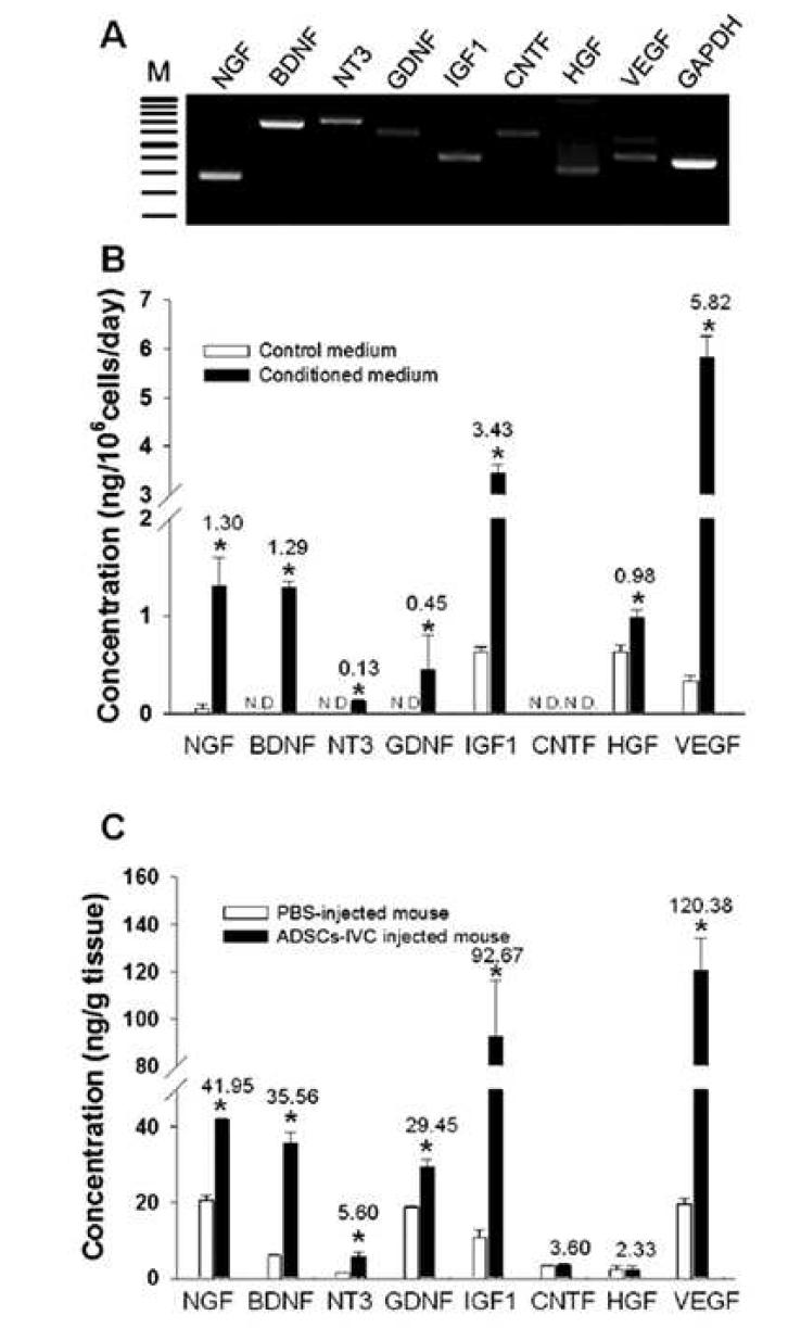 ADSC에서 cytokine과 growth facto의 RT- PCR과 ELISA 분석