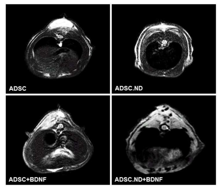 ADSC, ADSC- ND, ADSC+BDNF와 ADSC- ND+BDNF 이식 후 MRI 영상학적 분석.