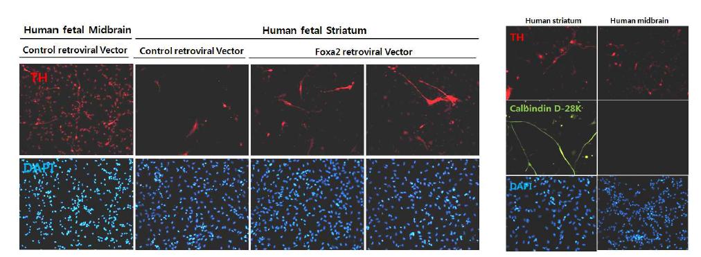 인태아 유래신경줄기세포에 FoxA2 유전자 도입에 의한 도파민신경세포의 분화의 그 특성