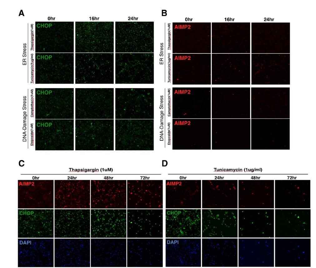 ER stress 유도물질 처리 후 시간에 따른 AIMP2와 CHOP 발현 양상
