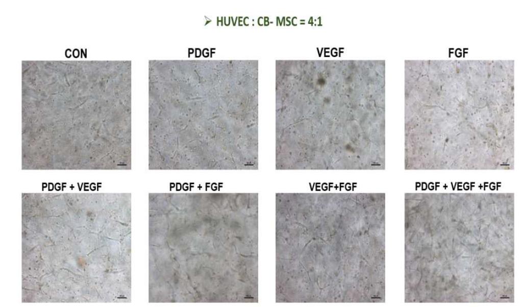 혈관생성 성장인자 (500ng/50ul)가 포합된 수화젤 내에서 혈관내피세포 및 중간엽줄기세포를 4:1로 co-culture하였을 때 세포의 morphology변화