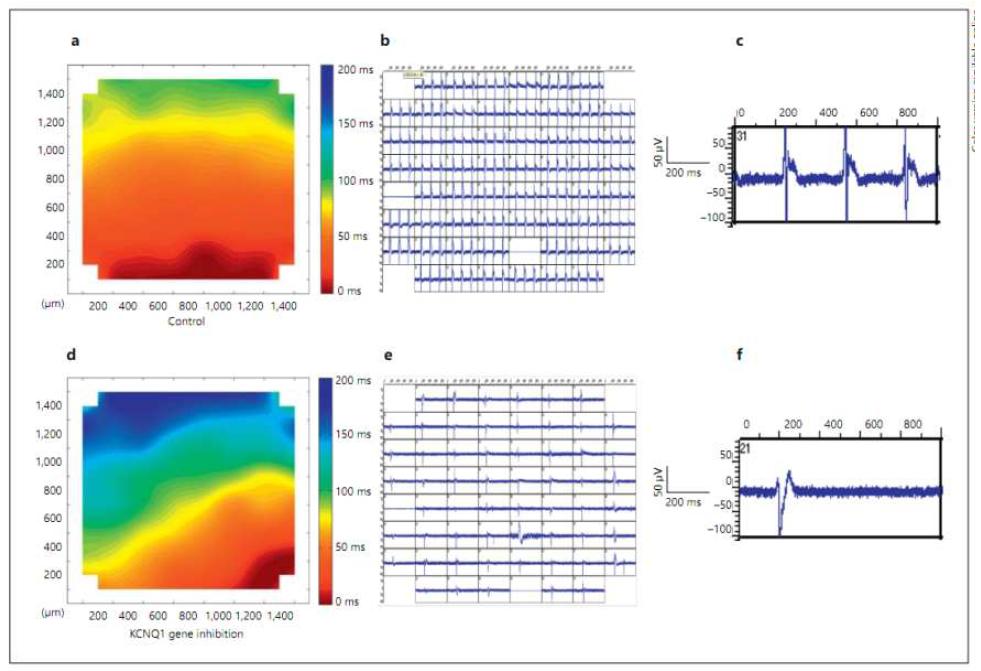 MEA(micro electrode array)를 이용하여 심장의 전기전도의 심장세포기능저하를 확인 (a,d) : MEA activation map (b,e):voltage amplitude (c,f) :cycle length , (a-c) :control group , (d-f) : 심장저하(bradycardia) 그룹