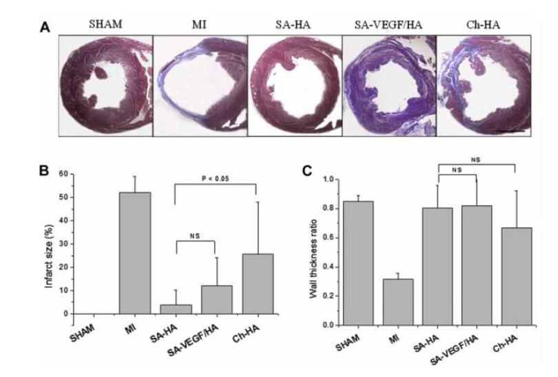 Morphology와 Histology 분석 : rat의 left ventricular infarct 된 부분에 hydrogel을 injection한 후 MT stain과 infarct size 측정 (A) Infarct size (B) Wall thickness (C) Left ventricles histology section에 의한 LV infarct size의 측정
