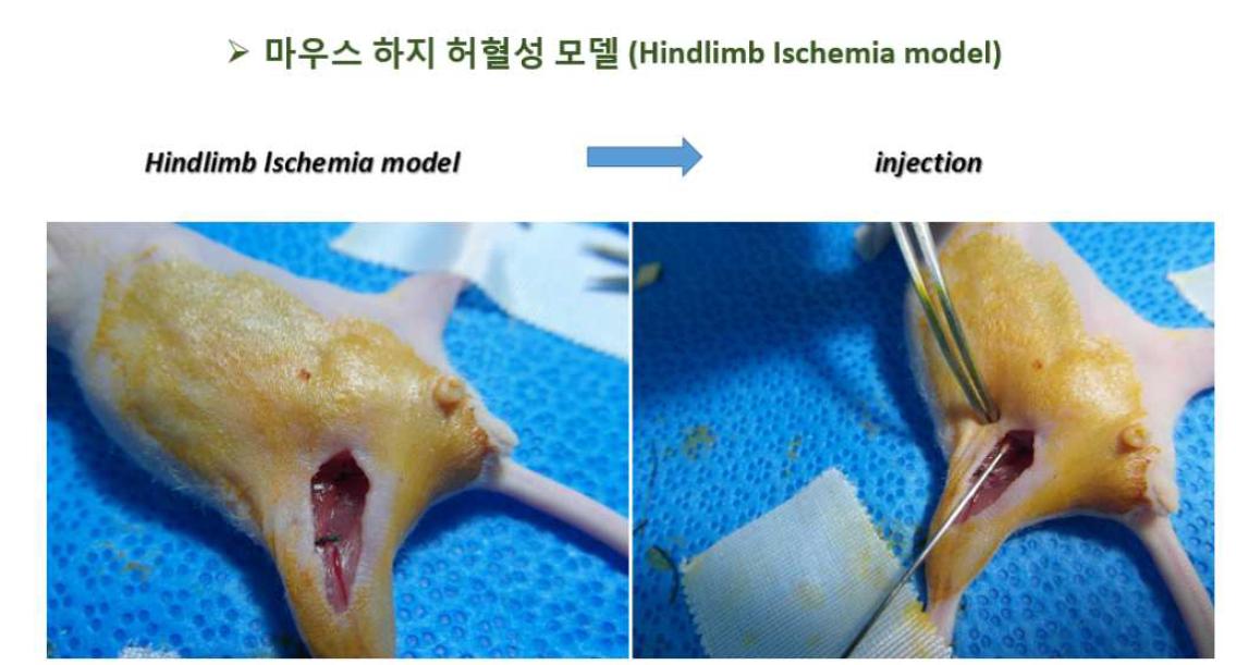 하지 허혈성 모델 제작 후 성장인자가 포함된 matrigel injection해 준 모습