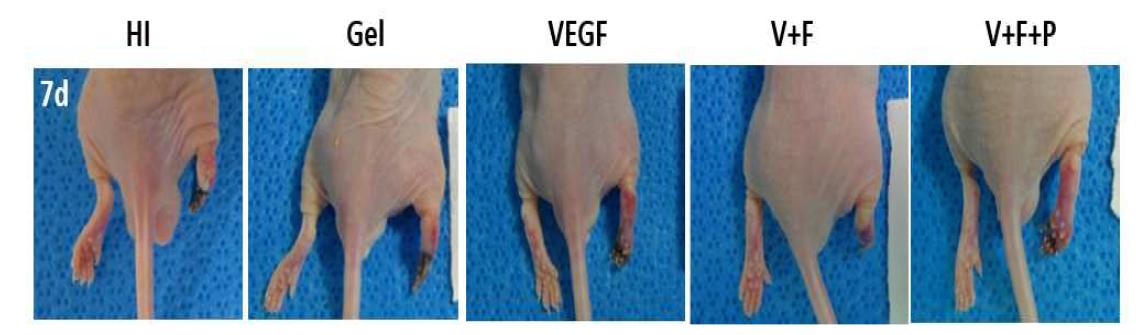하나의 성장인자 또는 두 개의 이상의 성장인자가 포함된 matrigel을 하지 허혈성몸델에 적용해 주었을 때 다리재생 정도 비교