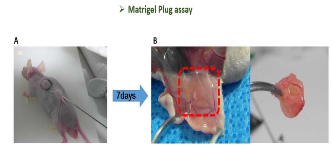 Matrigel Plug assay.