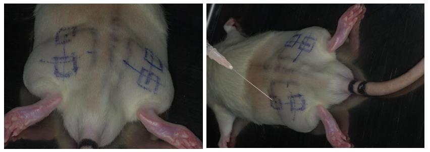 방사선 조사 위치에 따른 피하 주사 위치