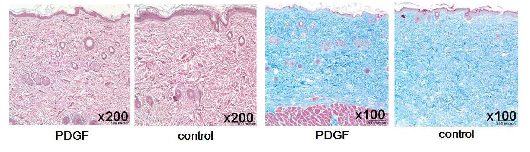 성장인자 주입군과 대조군의 조직염색