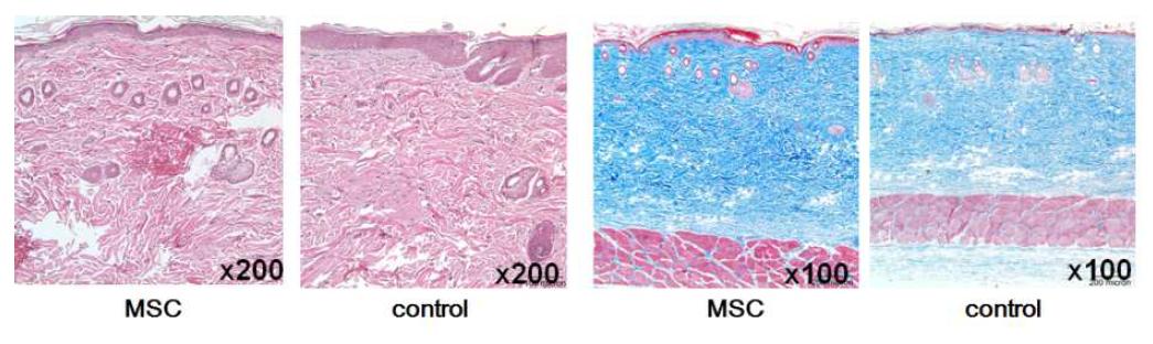 줄기세포 주입한 군과 대조군의 조직염색