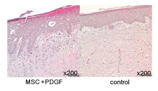 성장인자 (PDGF)와 줄기세포를 혼합주사한 실험군와 대조군의 조직염색