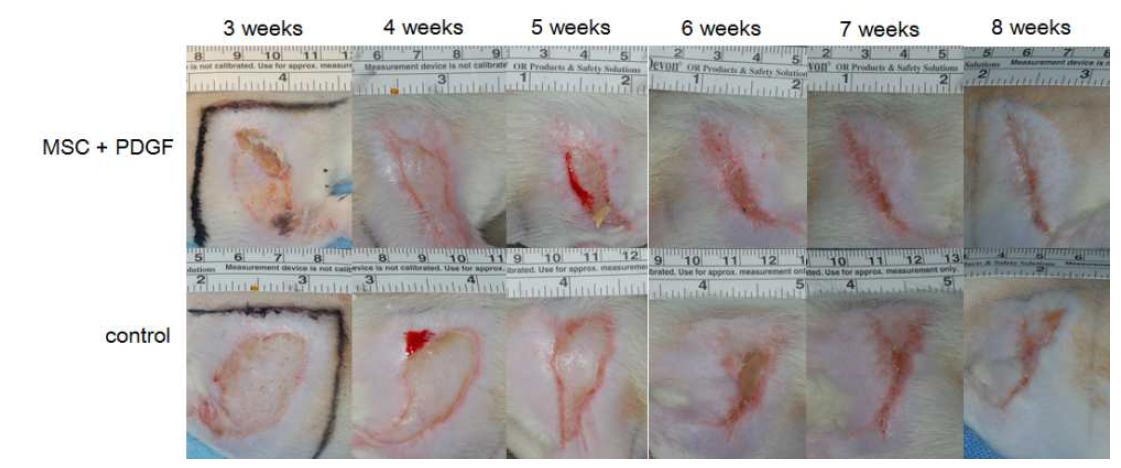 성장인자 (PDGF)와 줄기세포를 혼합주사한 실험군와 대조군 기간 경과에 따른 연조직 괴사 부위의 회복 정도