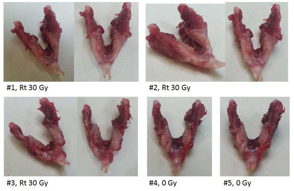 방사선 조사 후 적출한 하악골의 육안 소견