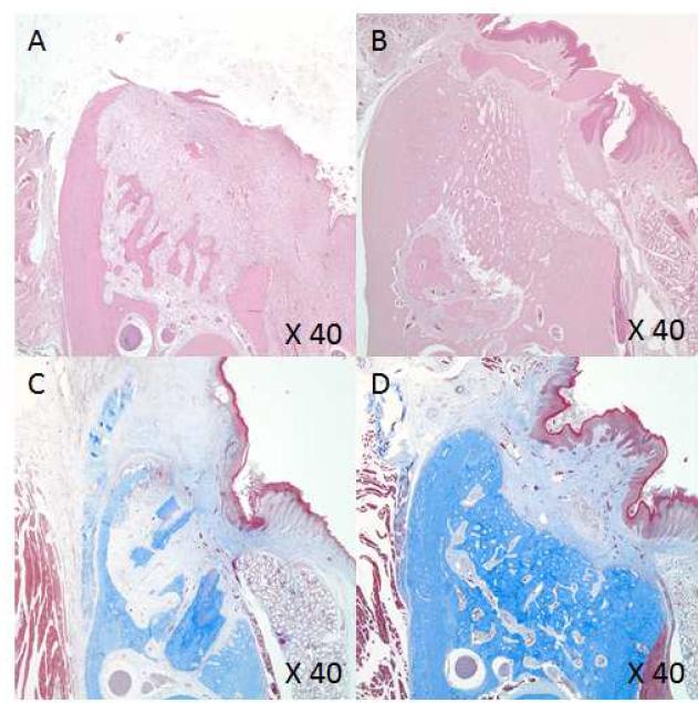 발치와. 대조군에서는 해면골 밀도가 낮으며 염증세포의 침윤이 관찰됨(A). 줄기세포가 포함된 하이드로젤 적용군에서는 높은 밀도의 해면골이 관찰됨(B)(H&E stain). 대조군(C)에서는 상피의 재생이 미약하고 교원질의 밀도가 낮은데 비하여 줄기세포 포함 하이드로젤 적용군에서는 높은 수준의 교원질 및 완전한 형태의 상피 재생이 관찰되며 혈관 밀도가 높음(D)