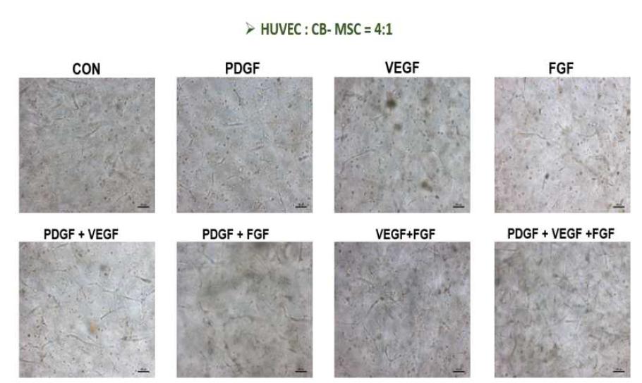혈관생성 성장인자 (500ng/50ul)가 포합된 수화젤 내에서 혈관내피세포 및 중간엽 줄기세포를 4:1로 co-culture하였을 때 세포의 morphology변화