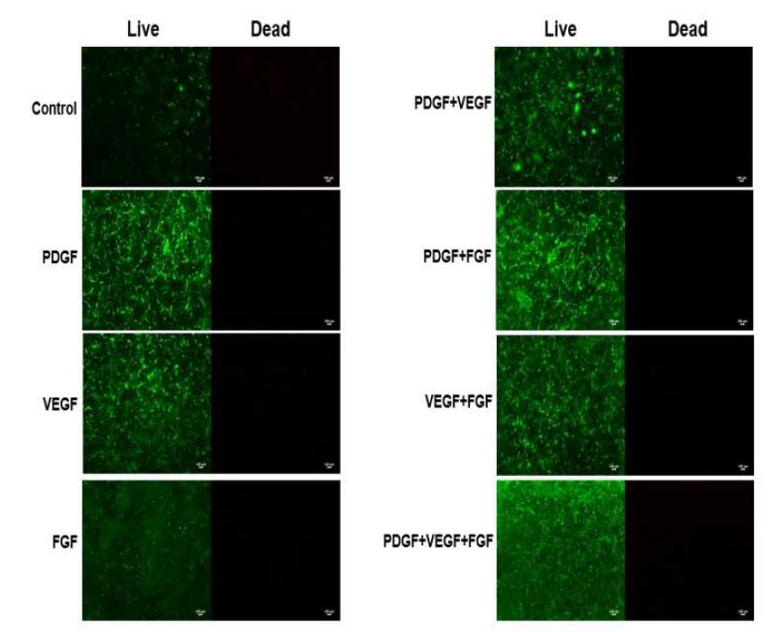 혈관생성 성장인자(500ng/50ul)가 포합된 수화젤 내에서 혈관내피세포 및 중간엽줄기 세포를 4:1로 co-culture하였을 때 세포의 생존율을 Live/Dead kit를 이용하여 염색한 결과 임