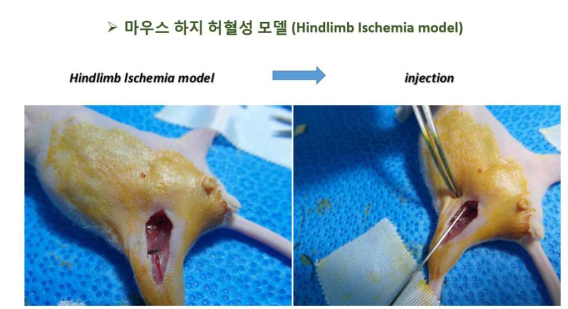 하지 허혈성 모델 제작 후 성장인자가 포함된 matrigel injection해 준 모습