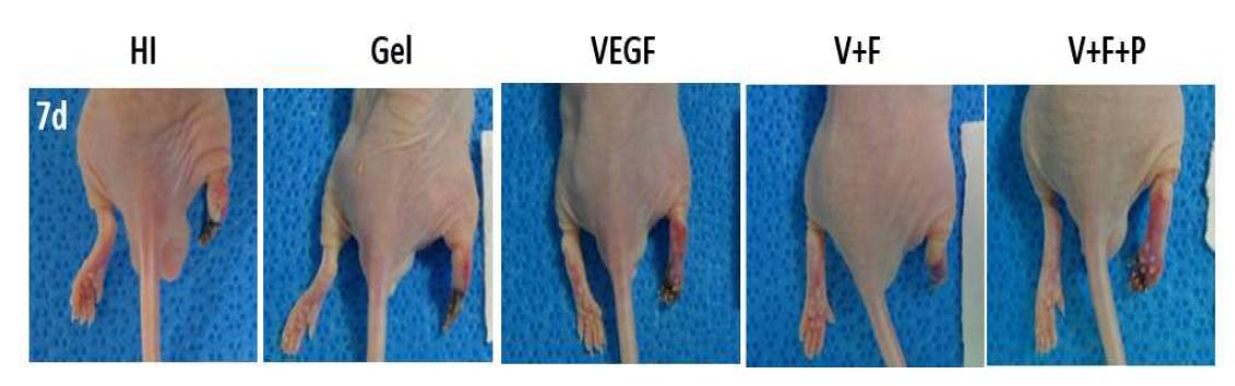 하나의 성장인자 또는 두 개의 이상의 성장인자가 포함된 matrigel을 하지 허혈성몸델에 적용해 주었을 때 다리재생 정도 비교