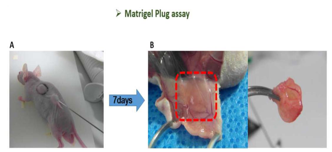 Matrigel Plug assay.