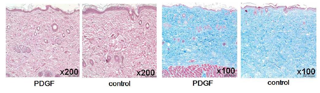 성장인자 주입군과 대조군의 조직염색