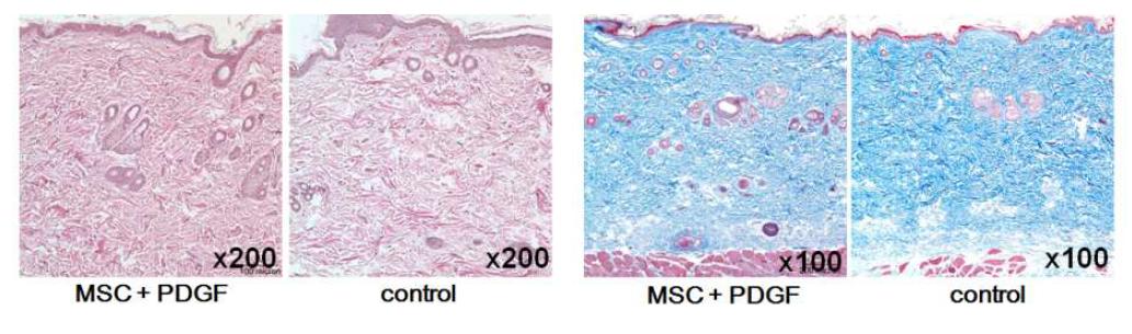줄기세포 및 성장인자 혼합주입군과 대조군의 조직염색