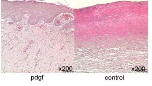 성장인자 주입군과 대조군의 조직 염색