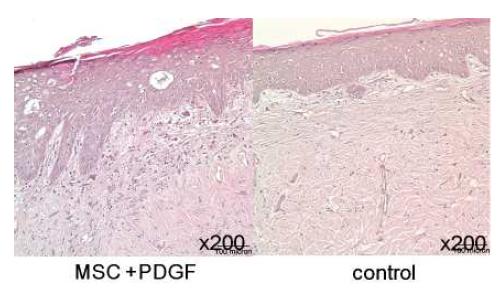 성장인자 (PDGF)와 줄기세포를 혼합주사한 실험군와 대조군의 조직염색