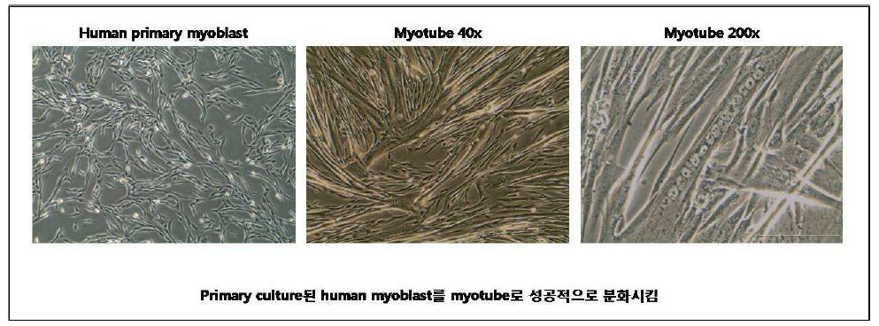 Myotube formarion의 확인으로 primary culture된 인간 myoblasts의 성공적인 분리를 확인함.