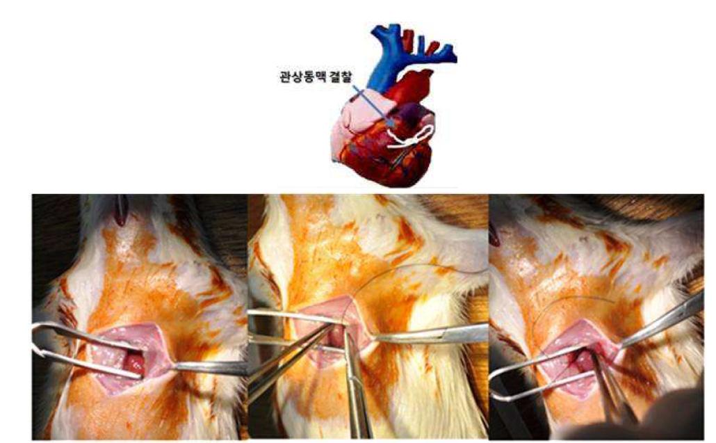 랫드의 심근경색 유도를 위한 수술법