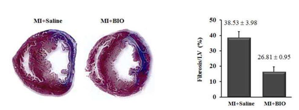 경색 심근의 심근섬유화 랫드 심근경색 유도 1주일 후, 경색 심근에 BIO 또는 vehicle (DMSO)를 주입하였음. 2주 후 심장조직의 심근섬유화 변화를 확인하기 위하여 Masson’s trichrome 염색을 시행하였음. BIO 주입군과 vehicle 주입군 사이의 심근섬유화에서 유의한 차이는 관찰되지 않았음.