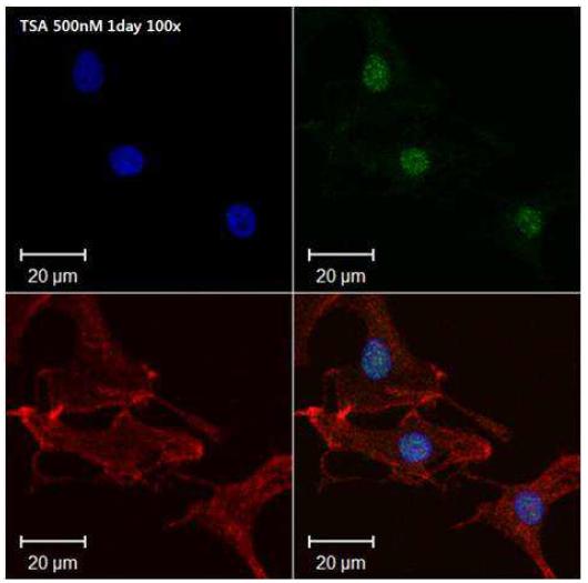TSA만 1일 동안 전처리한 돼지지방세포(핵에 DAPI 염색)와 함께 신생 백서 심근세포를직접적인 공배양한 후 gata4(green)와 cTnI(red)로 염색하여 심근세포로의 분화를 관찰하였음. 왼쪽 아래)가 발현되어 있음을 확인하였음. 즉, TSA만으로도 돼지지방세포가 심근세포로 어느정도 분화됨을 확인함
