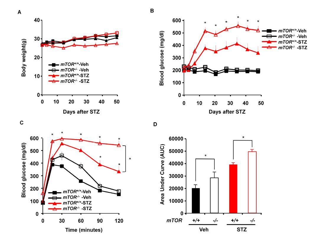 (A) streptozotocin injection후 body weight의 변화, (B) streptozotocin injection후 blood glucose 수치의 변화, (C) streptozotocin injection후 GTT, (D) (C)그래프의 area under curve (AUC) 측정함