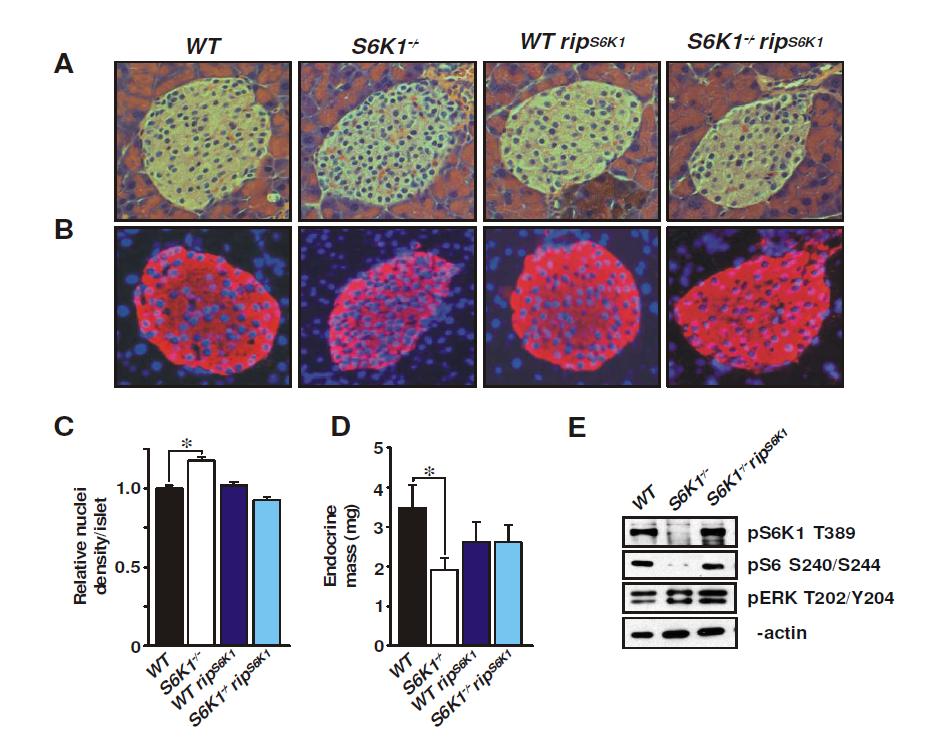 (A- E) S6K1 결핍 마우스는 췌장 β 세포 성장, 발달, β 세포 mass의 결함을 나타냄. 췌장 β 세포 특이적 S6K1 과발현 마우스 (RIP- S6K1 transgenic mice)를 S6K1 결핍 마우스와 교배하면, S6K1 결핍으로 인한 결함있는 췌장 β 세포 성장, 발달이 정상형으로 되돌아옴.