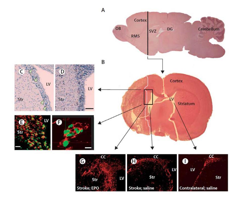 쥐 허혈 동물 모델에서 뇌실 주위(Subventricular zone: SVZ)에서 일어나는신경형성. A와 B는 각각 시상면과 관상면을 뇌의 신경형성을 담당하는 SVZ의 위치를 보여 줌. 그림 C에서 BrdU 염색에 양성을 보이는 (화살표) 활발히 증가하고 있는 세포를 확인.