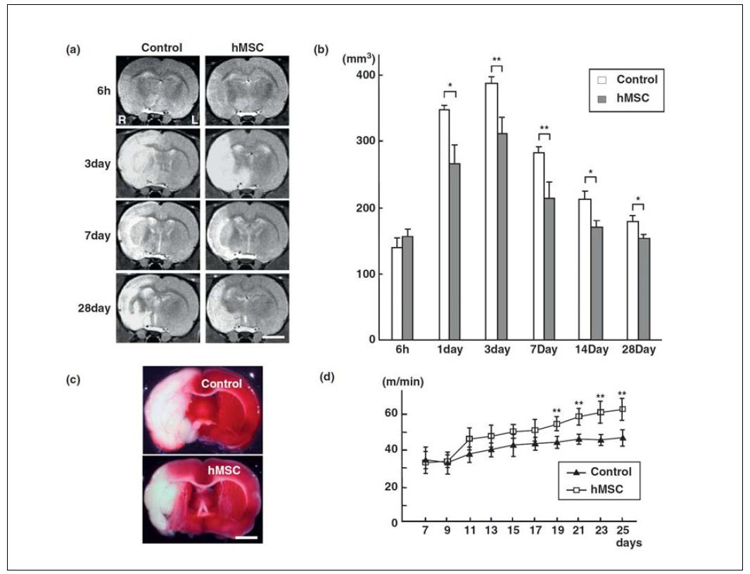 줄기 세포 주입을 통한 뇌경색 부피의 감소와 운동 개선 효과.