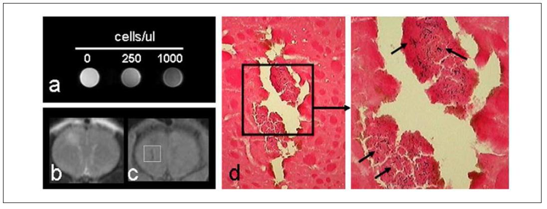 (a) 각각 ferumoxide 가 주입된 세포의 농도에 따라 MR 영상의 소견 (b and c) 중대뇌 동맥 영역에 경색이 생긴 부위 (b)에 저신호강도로 보이는 부위 (c)가 iron oxide를 함유하고 있는 세포가 침착된 소견임. Prussian blue 염색에서 푸르게 보이는 iron oxide의 침착을 확인할 수 있음.