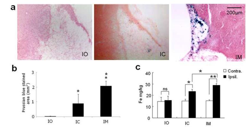 Ion oxide를 주입한 신경줄기세포가 자석으로 유도되어 효과적으로 병변으로 이동. (a) 프러시안 블루 염색. 나노입자로 표지된 신경줄기세포를 주입 후 자석으로 유도 하여 뇌손상 부위로 이동. IO, MCAo(허혈성 뇌졸중 실험 모델) 쥐의 뇌 손상 부위; IC, MCAo 쥐에 F3 human NSCs를 이식 후 뇌 손상 부위; IM, MCAo 쥐에 F3 human NSCs를 이식후 자석으로 유도 (b) 단위면적당 염색된 세포 수 (C) 쥐 뇌조직의 철함량