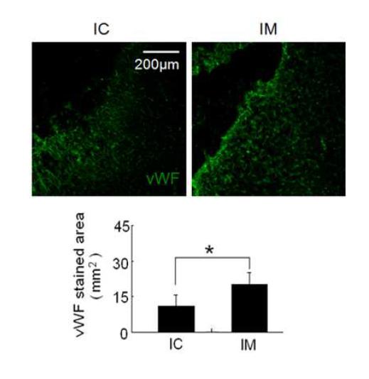 주입한 인간 신경줄기세포가 뇌 조직에서 분화되었는지 면역학적 염색을 통한 확인. MCAo 후 28일째. 뇌손상 부위에서 von Willebrand factor (green: vWF)로 염색된 세포들. vWF는 endothelial cell들을 나타내며 이 수의 증가는 혈관재생을 나타냄. 자석으로 유도된 경우 혈관재생이 더 효과적이었다