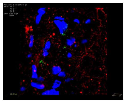 NF- L 염색. 초록색: FION- FITC 파란색: DAPI 붉은색: NF- L