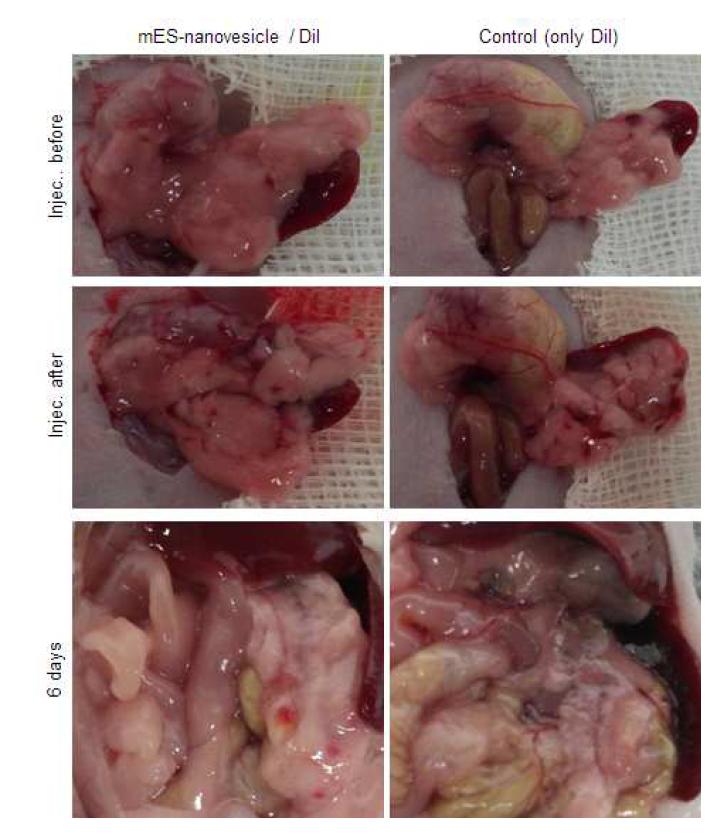 인공 소포의 췌장내 국소 주입을 통한 췌장의 조직학적 관찰.
