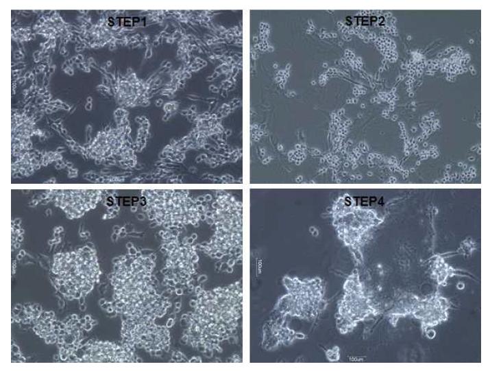 인공 소포 역분화줄기세포의 분화 과정.