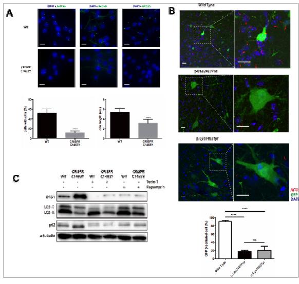 난치성 뇌전증 유발 mTOR 뇌체성 유전 변이에 의해 autophagy-mediated ciliogenesis가 억제됨을 보여주는 in vivo 데이터