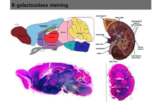 b-gal staining을 통하여 endogeneous tmem138 발현 부위를 Tmem138 heterozygote mouse의 brain과 kidney에서 관찰함
