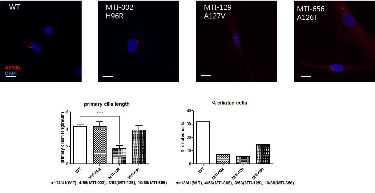 Tmem138 관련 ciliopathy 분자 생물학적 기전 연구를 위한 Tmem138 antibody 제작함