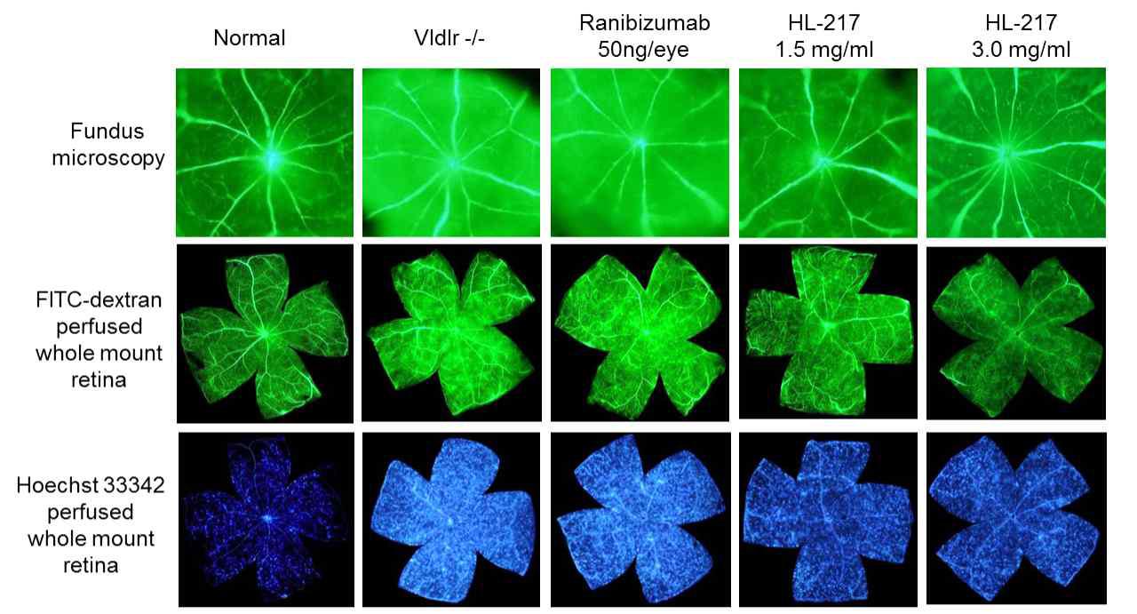 Three-weeks treatment of HL-217 inhibited pathogenic subretinal neovessels and retinal vascular leakage in Vldlr-/- mouse.