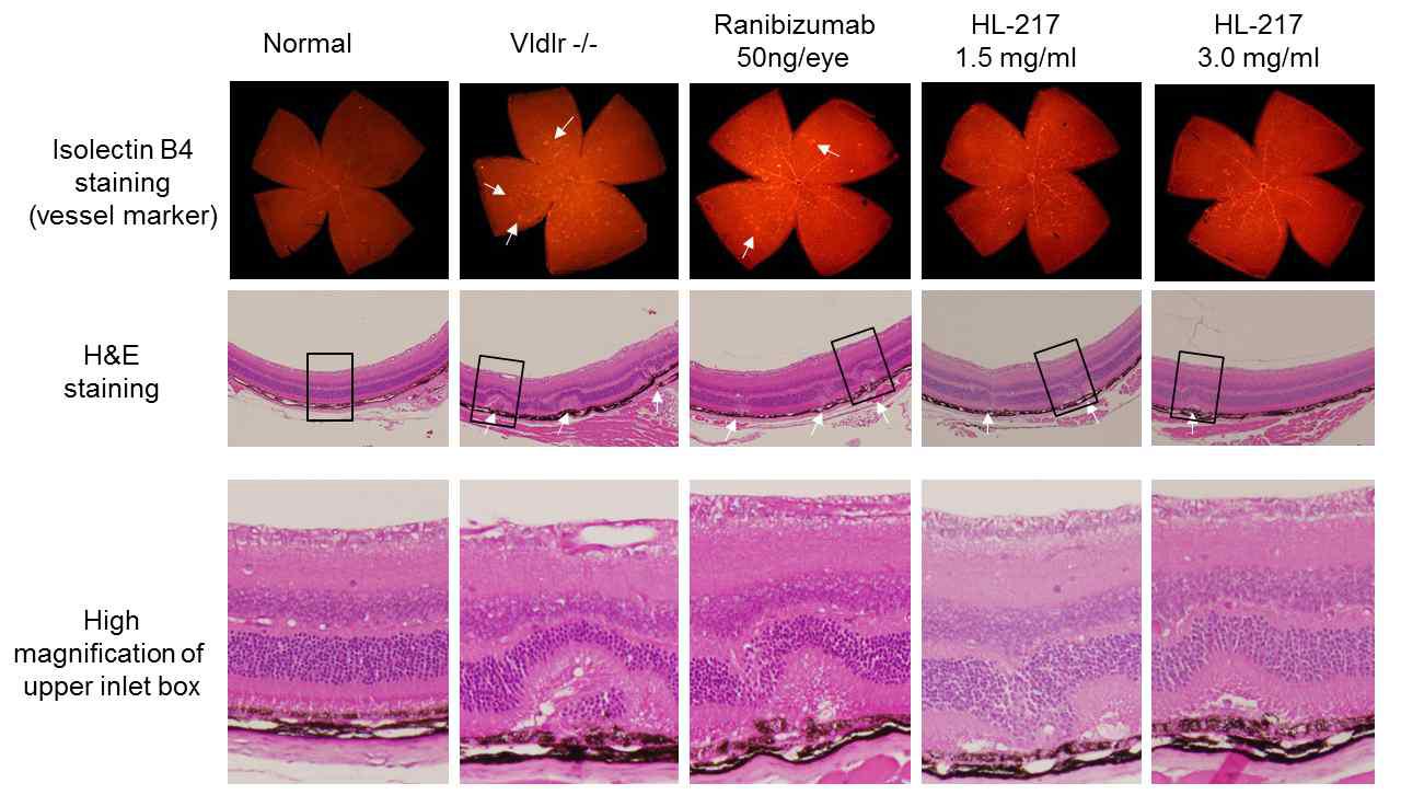 HL-217 inhibited pathogenic subretinal neovessels in Vldlr-/- mouse.