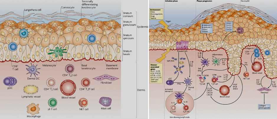 피부의 구조 (좌)와 피부 건선 질환에 관련된 여러 요인들 (우)