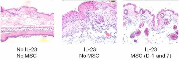 MSC에 의한 건선유사 피부염증 억제효과의 조직학적 검사