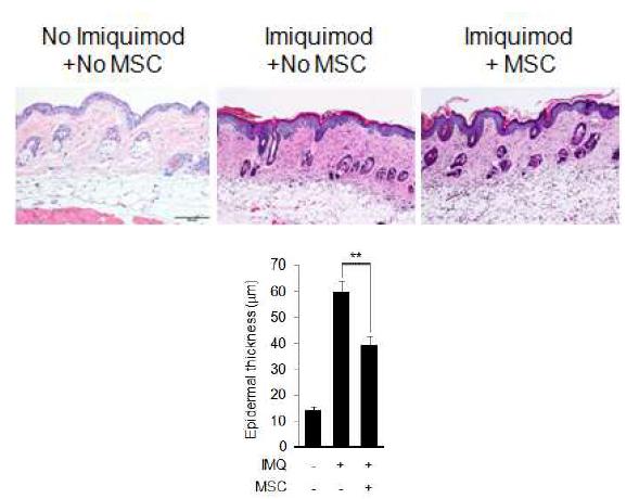 MSC에 의한 건선유사 피부염증 억제효과의 조직학적 검사