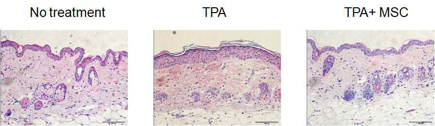 MSC에 의한 피부염증 억제효과의 조직학적 검사